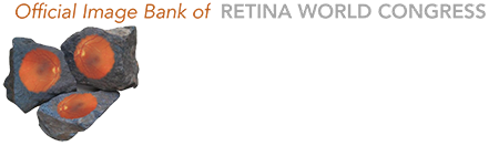 Retina Rocks - Retina Image and Reference Library